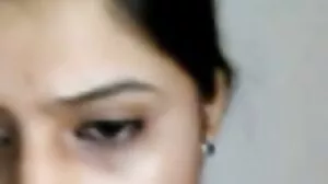 කයිලා සමඟ ගුද පරිහානිය